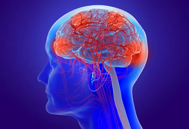 Marijuana Use Tied to Epilepsy?